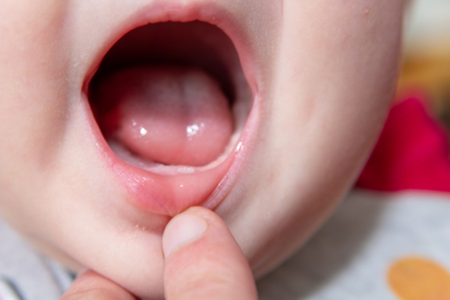 Quand et comment gérer l'apparition de la première dent de bébé ?